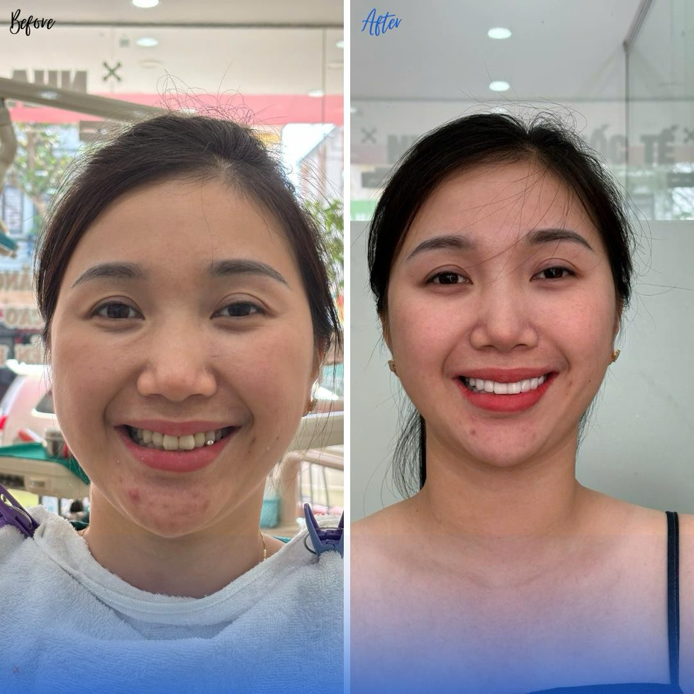 anh2