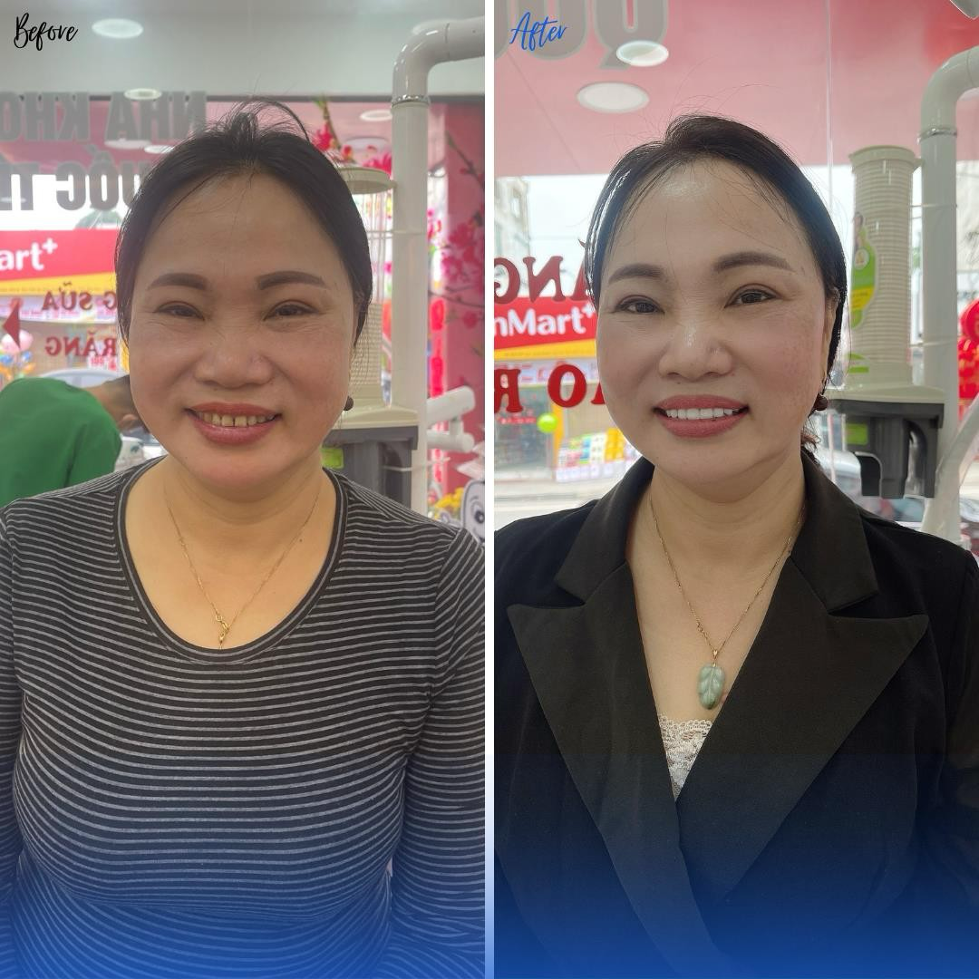 anh3