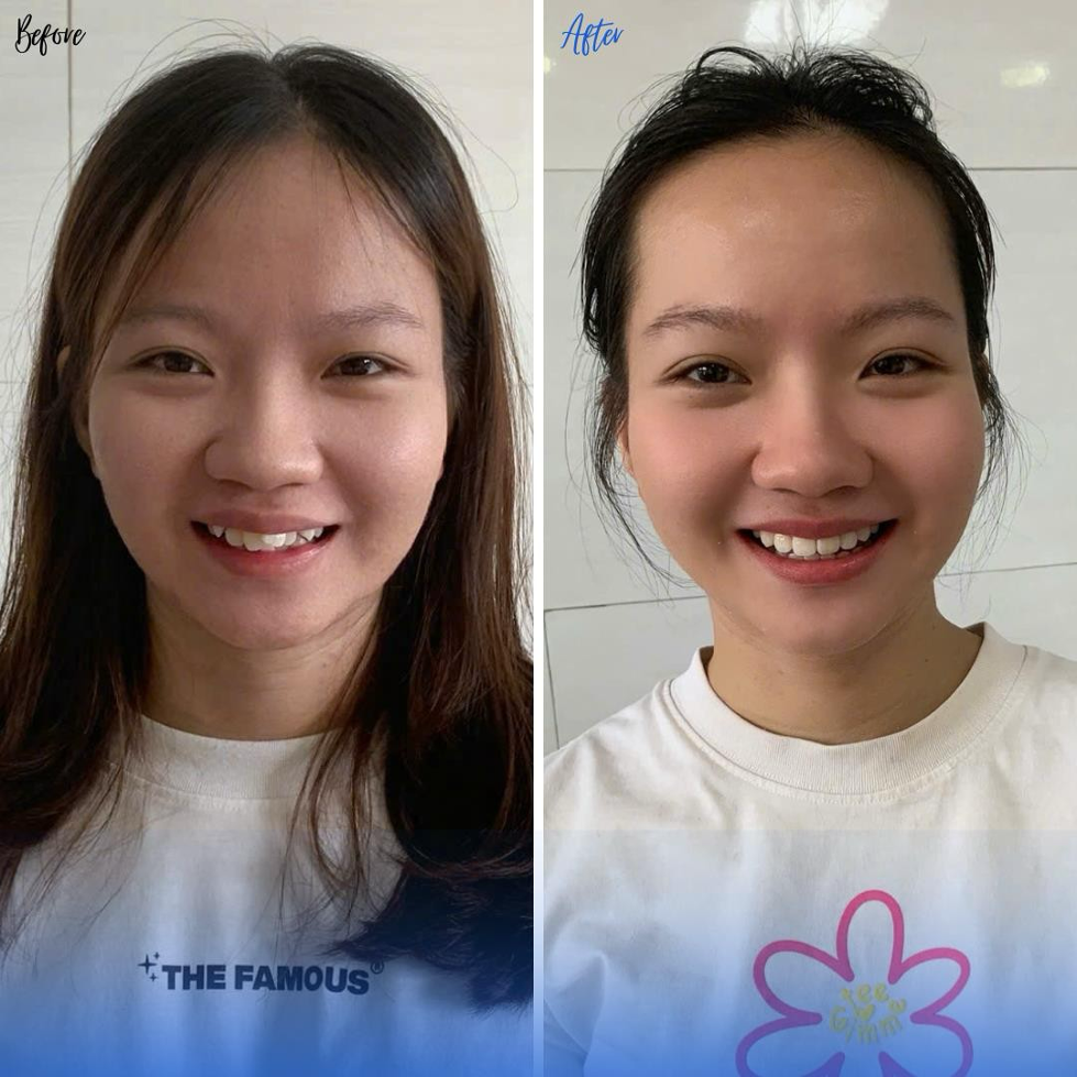anh5